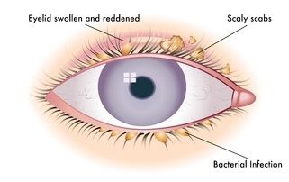 Eye Health