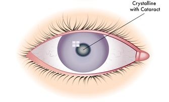 Eye Health